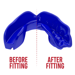 SafeJawz Mouth Guards Safejawz Intro Range Mouthguard Blue