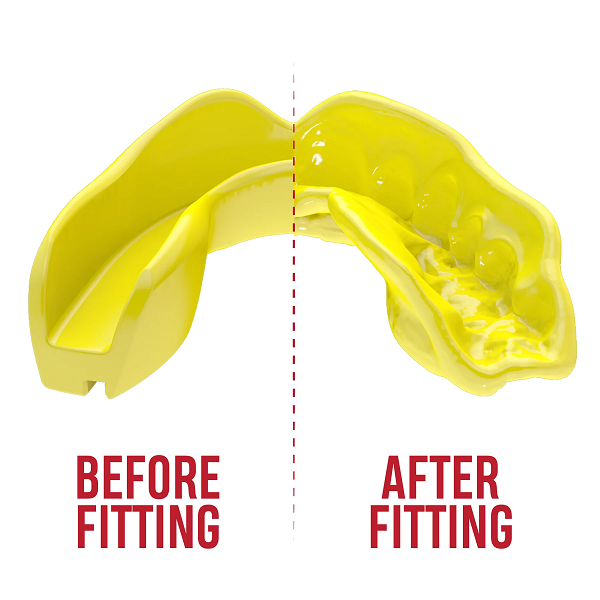 SafeJawz Mouth Guards Safejawz Intro Range Mouthguard Fluro Yellow