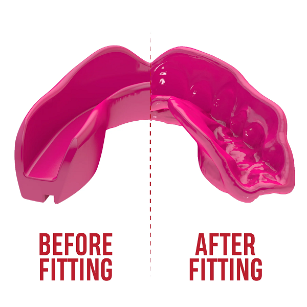 SafeJawz Mouth Guards Safejawz Intro Range Mouthguard Pink